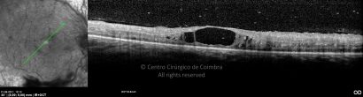 o34-ti03-2144284-20110621-002