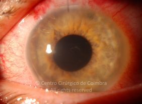 o36-ti12-4870-20100923-006