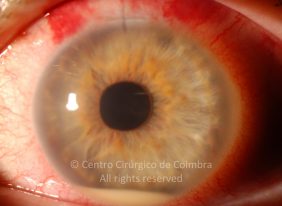 o38-ti12-4870-20100924-001