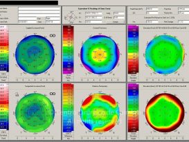 o45-ti17-2147161-20110330-002