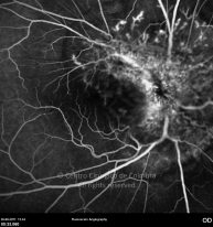 o49-ti07-2151183-20110826-004
