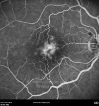 o59-ti07-131397-20100716-007