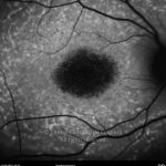o02-ti15-2134344-20100913-001