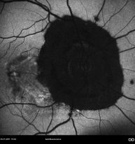 o17-ti15-132073-20111103-004
