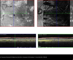 11-2156012-20191204-011-octa