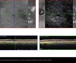 11-2156012-20191204-012-octa