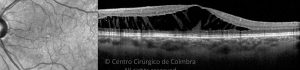 11-2313471-20220408-001