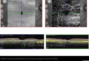 11-29378-20220110-005-octa