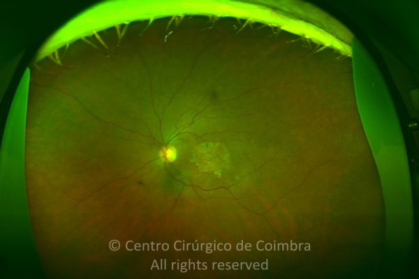 o02-ti02-12706-20111128-994-1-1024x807