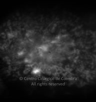 33-2277067-20210715-014-angio