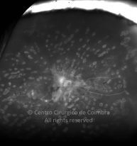 33-2277067-20210715-015-angio
