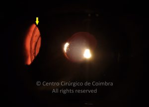 15-2336490-20240228-002