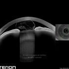 11-2342546-20240408-001-anterion