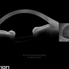 11-2342546-20240418-002-anterion