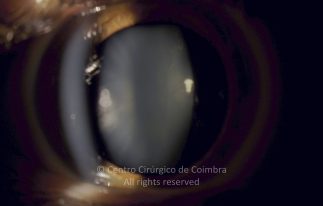 15-130463-20180302-001