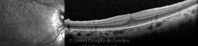 11-2198535-20240320-2ª imagem