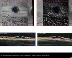 11-130463-20250411-001-OCTA