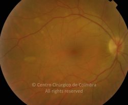 03-2152181-20130117-001