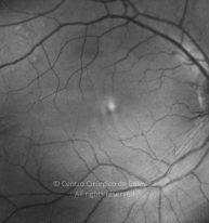 11-2152181-20130117-008-red free