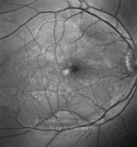 11-2152181-20130301-001-redfree