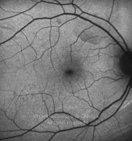 11-2152181-20130301-002-autofl