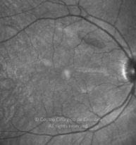 11-2152181-20130301-003-IR