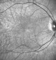 11-2152181-20190118-001-IR