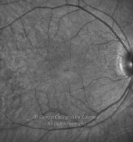 11-2152181-20211216-001-IR