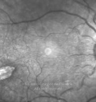 11-2322380-20220830-001-IV