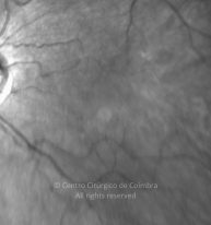 11-2322380-20220830-002-IV