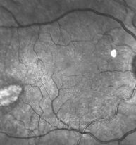 11-2322380-20251118-003-IV