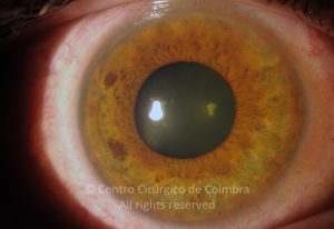 15-2152181-20130109-001