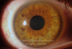 15-2152181-20130117-001