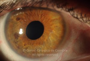 15-2152181-20190118-001