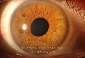 15-2152181-20211216-001