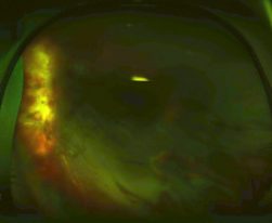 33-2152181-20130107-001