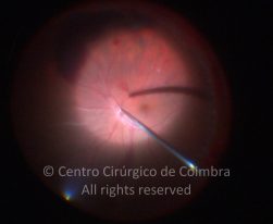 33-2152181-20130107-01-5