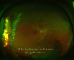 33-2152181-20130108-01