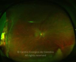 33-2152181-20130117-001