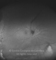 33-2152181-20130117-002-autofl