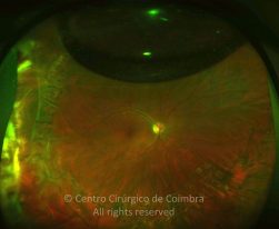 33-2152181-20130301-001