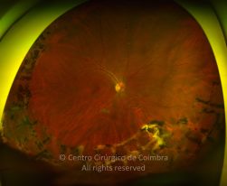 33-2152181-20190118-001