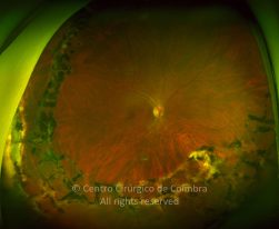 33-2152181-20211216-001