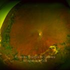 33-2152181-20211216-002