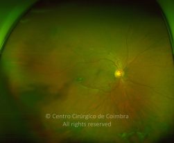 33-2322380-20220830-001