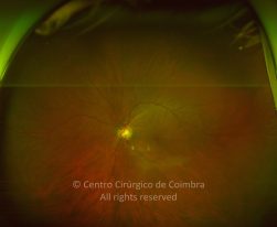 33-2322380-20220830-002