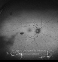 33-2322380-20220830-003-Autofluorescência