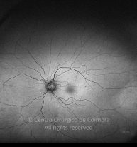 33-2322380-20220830-004-Autofluorescência