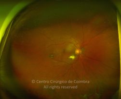 33-2322380-20230908-001